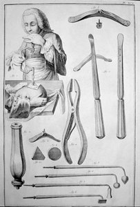Trepanering av hodeskallen, forskjellige instrumenter (gravering av Unknown artist