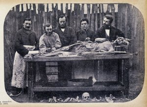 Disseksjon, v.1865. av Unknown photographer