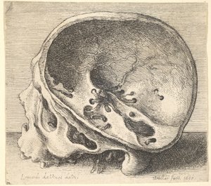 Seksjonert hodeskalle i profil til venstre med venstre side av kraniet fjernet, 1651. av Wenceslaus Hollar