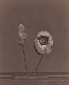 Utskåret kneledd. En rund muskettball i den indre kondylen til høyre lårben [Gardin..., 1866-67.