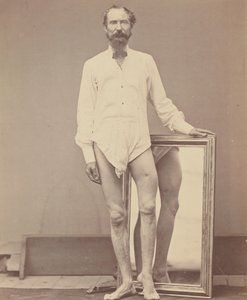 Gunshot Wound of Middle Third of Left Femur, 1865-67.    1137913   no       norwegian Successfully Translated  Original: Bjernede kirke Translat: Bjernede kirke 1281142 no norwegian Successfully Translated Original: The Waterproof Coat of General Moltke Tr