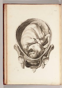 Gravering av et barn i livmoren fra "A Set of Anatomical Tables, with Explanations, and a Abridgement, of the Practice of Midwifery", 1754