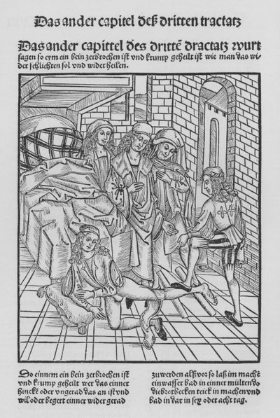 The Book of Cirurgia av Hieronymus Brunschwig (litho) av (after) German School