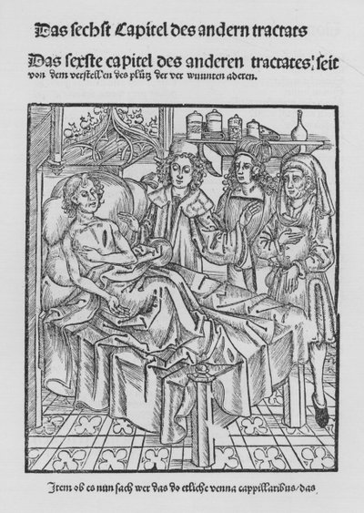 The Book of Cirurgia av Hieronymus Brunschwig (litho) av (after) German School