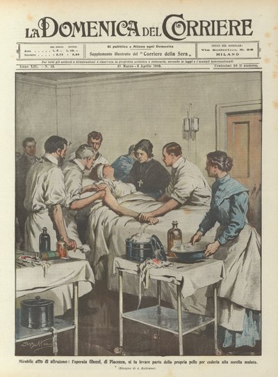 Beundringsverdig altruisme, arbeideren Ghezzi, fra Piacenza, har en del av huden hennes fjernet? av Achille Beltrame