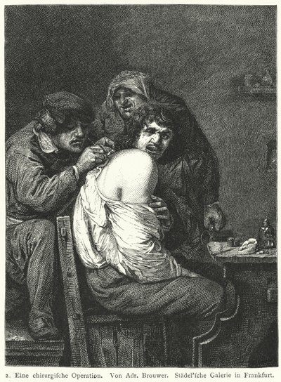 Ryggoperasjonen av Adriaen (after) Brouwer