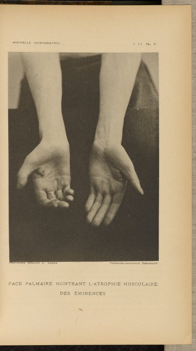  av Albert Londe
