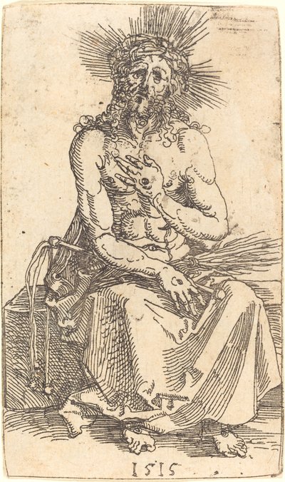 Sorgens mann sitter av Albrecht Dürer