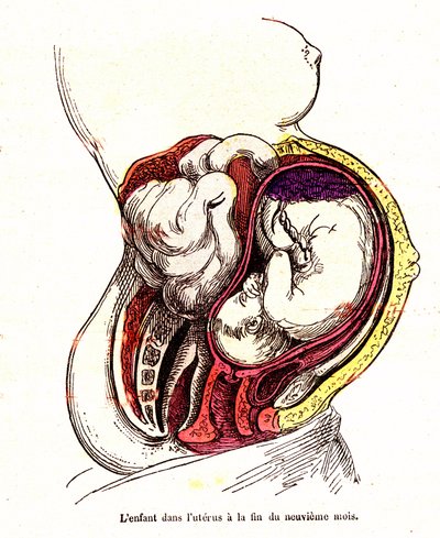Barnet i livmoren (sen 9. måned) - J. Rengades normale liv og helse - Tegning A.Demarle 1881 av Alphonse Demarle