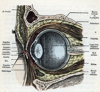 Vertikalt snitt av et øyeeplet med grå stær gravering fra "Nature and Man" av Rengade 1881 Privat samling av Alphonse Demarle