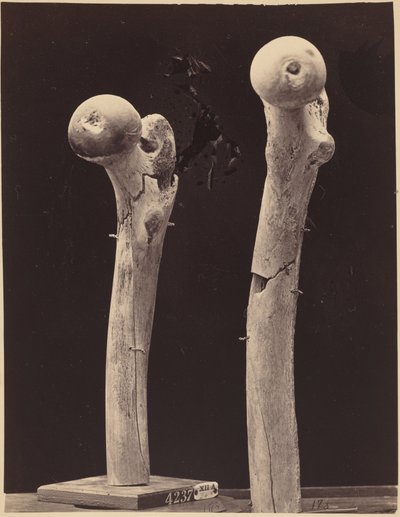 Prøver av skuddbrudd i lårbenet, ca. 1867 (foto) av American Photographer