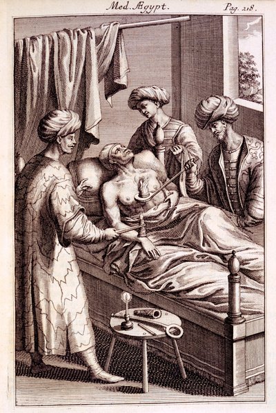 Illustrasjon av moxibustion fra Medicina Aegyptorum av Prospero Alpinus, 1745 av American School