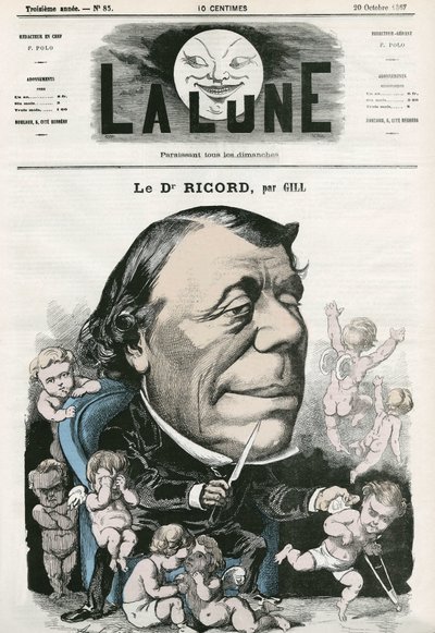 Portrett av doktor Ricord, fransk lege. Tegneserie av Gill, i «La Lune», 20. oktober av Andre Gill