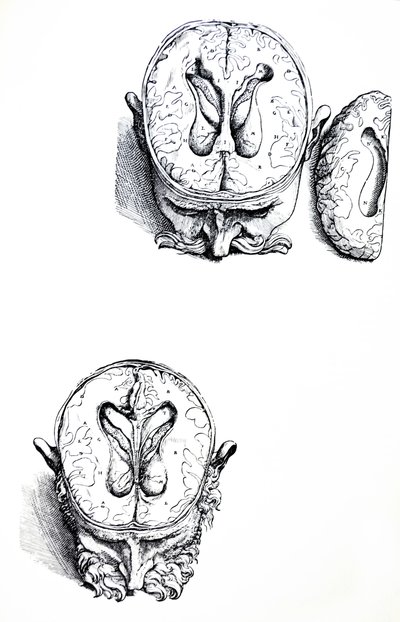 Platene fra den syvende boken til De Humani Corporis Fabrica av Andreas Vesalius