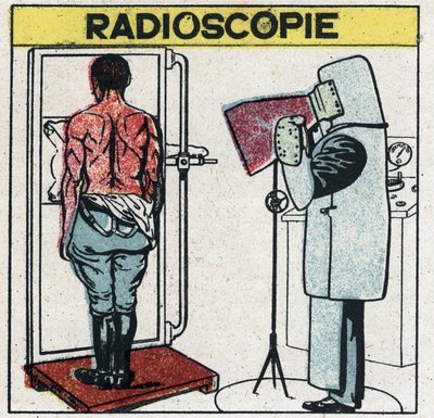 X-rays: radioscopy of a human body. The radiologist protects himself from X-rays by wearing a rubber cloth cloth with a rubber dissolution containing lead salts, his head is covered with a cap and his hands with gloves from the same fabric, his eyes are pr av Anonymous Anonymous