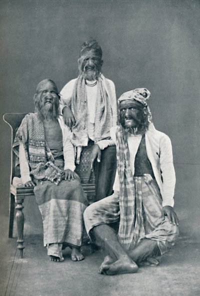 En hårete familie fra Mandalay, Burma, 1902 av Bourne and Shepherd
