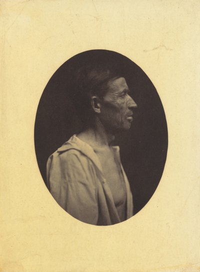 Et portrett, sett i profil, av en mann 42 år gammel, bedøvet av misbruk av alkohol..., 1854-1856. av Duchenne de Boulogne