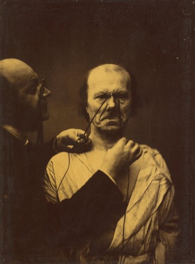 Aggression, ondskap, 1854-1856, trykt 1862. av Duchenne de Boulogne