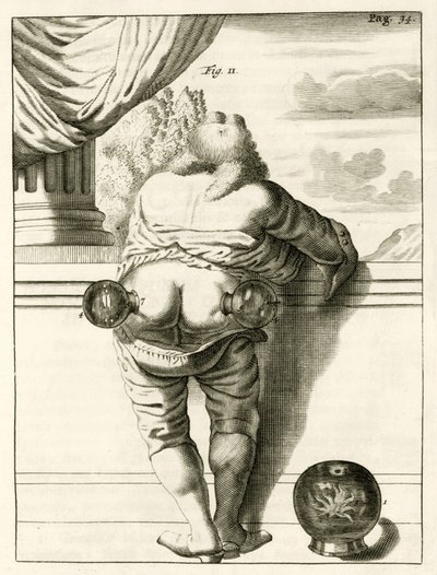 Et eksempel på kopping, fra The Practice of Medicine av Frederik Dekkers, 1694 av Dutch School
