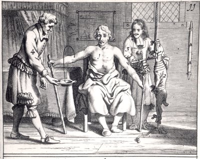 Blodoverføring fra en hund, fra Armamentarii Chirurgici av Johannes Schultes (1595-1645) utgitt i Amsterdam, 1671 av Dutch School