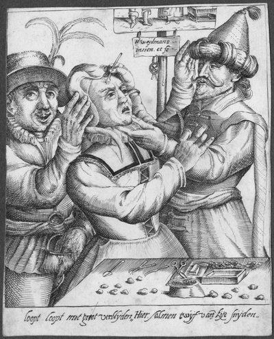 Trepanning, gravert av H. Weydmans (1500-tallet) av Dutch School