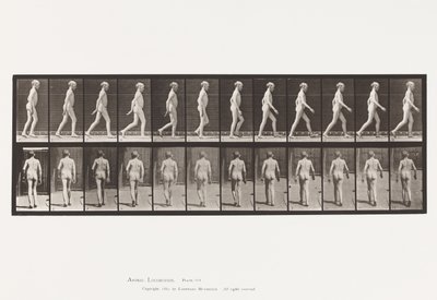 Plate 562. Lateral Curvature of Spine; Går av Eadweard Muybridge