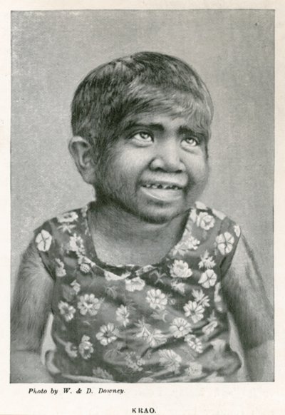 Krao, The Missing Link, utstilt på Aquarium, Westminster, London, i 1887 av English Photographer