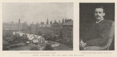 Dronning Alexandra og lyskuren for lupus av English Photographer