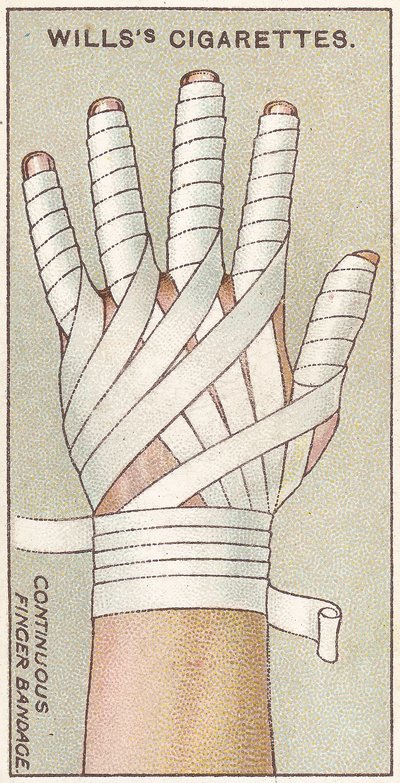 Kontinuerlig fingerbandasje, nr. 48 fra First Aid-serien med Willss Cigarettes-kort, 1913 av English School