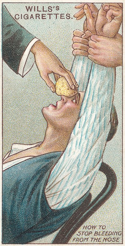 How to Stop Bleeding from the Nose, nr.31 fra First Aid-serien med Willss Cigarettes-kort, 1913 av English School