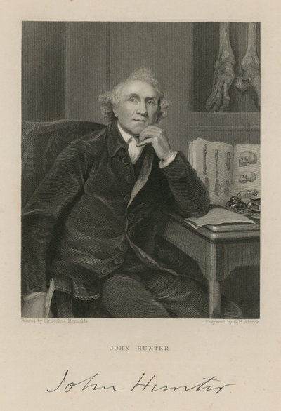 John Hunter av English School