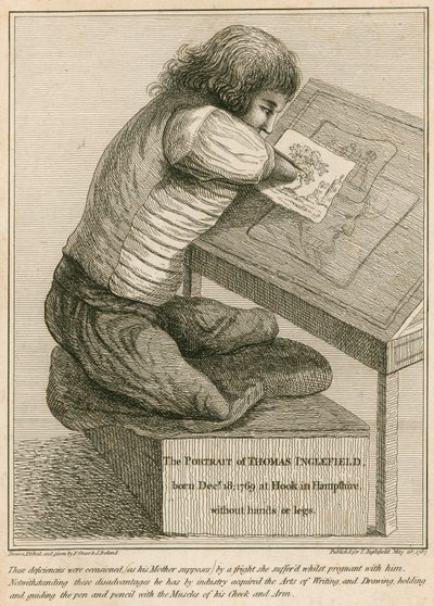 Thomas Inglefield, født 18. desember 1769 i Hook, Hampshire, uten armer eller ben av English School