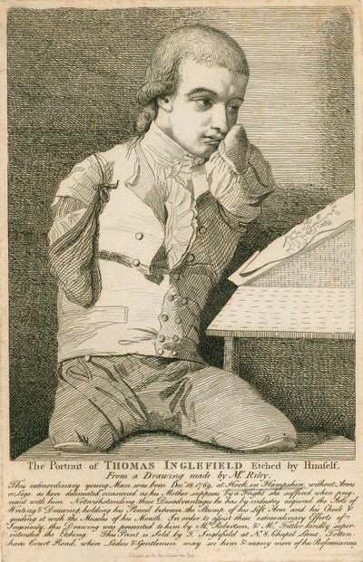 Thomas Inglefield, født 18. desember 1769 i Hook, Hampshire, uten armer eller ben av English School