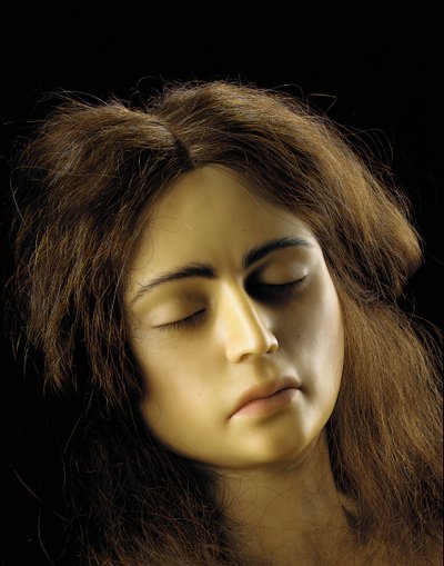 Anatomisk modell av en eggstokkgraviditet, detalj av European School