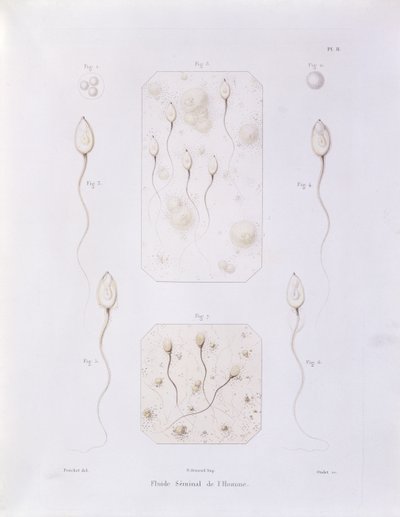 Sædvæske, fra Theorie Positive de lOvulation Spontanee et de la Fecondation des Mammiferes et de lEspece Humaine av Felix-Archimede Pouchet (1800-72) gravert av Oudet, Paris, 1847 (farget eng. av Felix Archimede Pouchet
