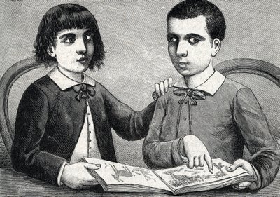 Barn med konvergent og divergerende skjeling eller kryssede øyne (gravering) 1888 av French School