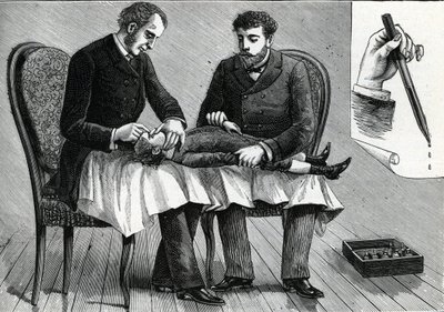 Leger som undersøker et barns øyne og injiserer øyedråper (gravering) 1888 av French School