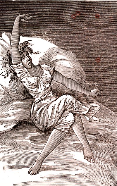 Hodepine, melankoli og hysteri, angst. 1887 (gravering) av French School