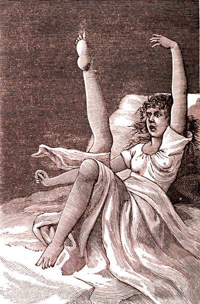 Hysteri, et ekstremt mentalt fenomen, psykoser og psykoneurose.1887 (gravering) av French School