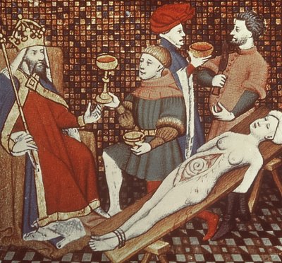 Ms 5193 f.290v Nero dissekerer moren sin, fra Jean Sans Peur-utgaven av The Cases of Men illustrert av Giovanni Boccaccio (1313-75) ca. 1410 av French School
