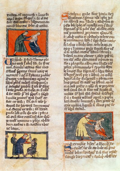 Ms H 89 fol.17r Surgery, fra en utgave av 