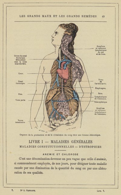 Organer for blodproduksjon og sirkulasjon hos en klorotisk kvinne (farge litho) av French School