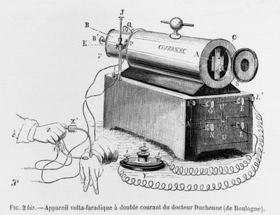 Volta Faradic Apparatus brukt av Guillaume Benjamin Duchenne de Boulogne (1806-75) illustrasjon fra Mechanism of Human Physiognomy or Electrophysiological Analysis of the Passions av Duchenne de Boul av French School