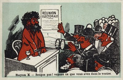 Røntgen - Ikke beveg deg! La oss se hva han har i magen av French School