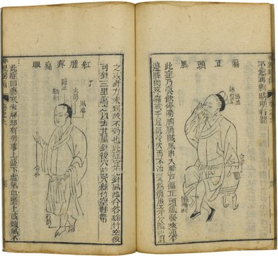 Shen Shi Yao Han A Precious Book of Ophthalmology, 1644 av Fu Renyu