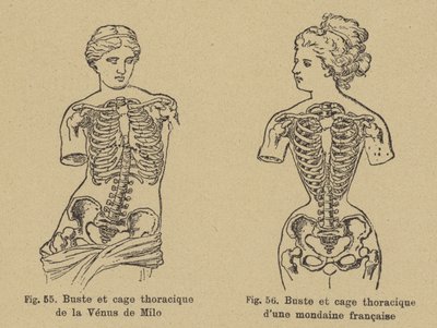 Sammenligning av formen på brystet og brystkassen til Venus de Milo med formen til en fransk sosialist fra slutten av 1800-tallet av German School