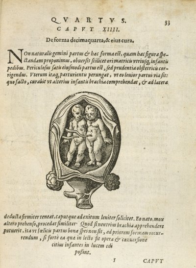 Ikke-identiske tvillinger i livmoren, illustrasjon fra kapittel 14, bok 4 av On the Conception and Growth of Man av Rueff, 1587 av German School