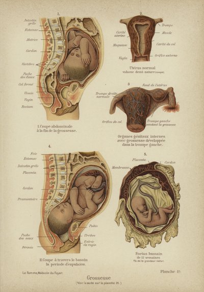 Graviditet (farge litho) av German School