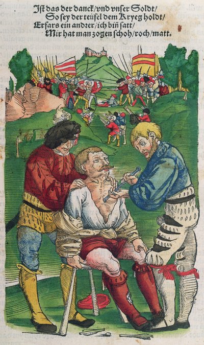 Fjerning av en pil, illustrasjon fra Feldtbuch der Wundartzney av Hans von Gersdorff, 1540 av German School