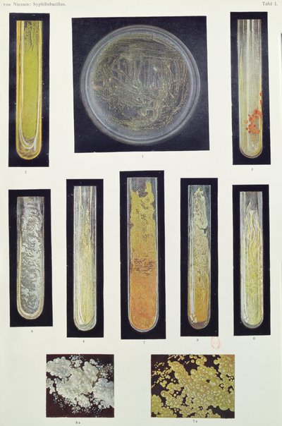 Syphilus Bacillus, fra en bok av Max von Niessen, Leipzig, 1908 av German School